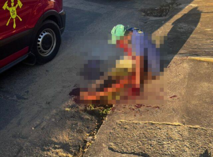 Homem é baleado na cabeça em Guarus e caso é investigado pela polícia