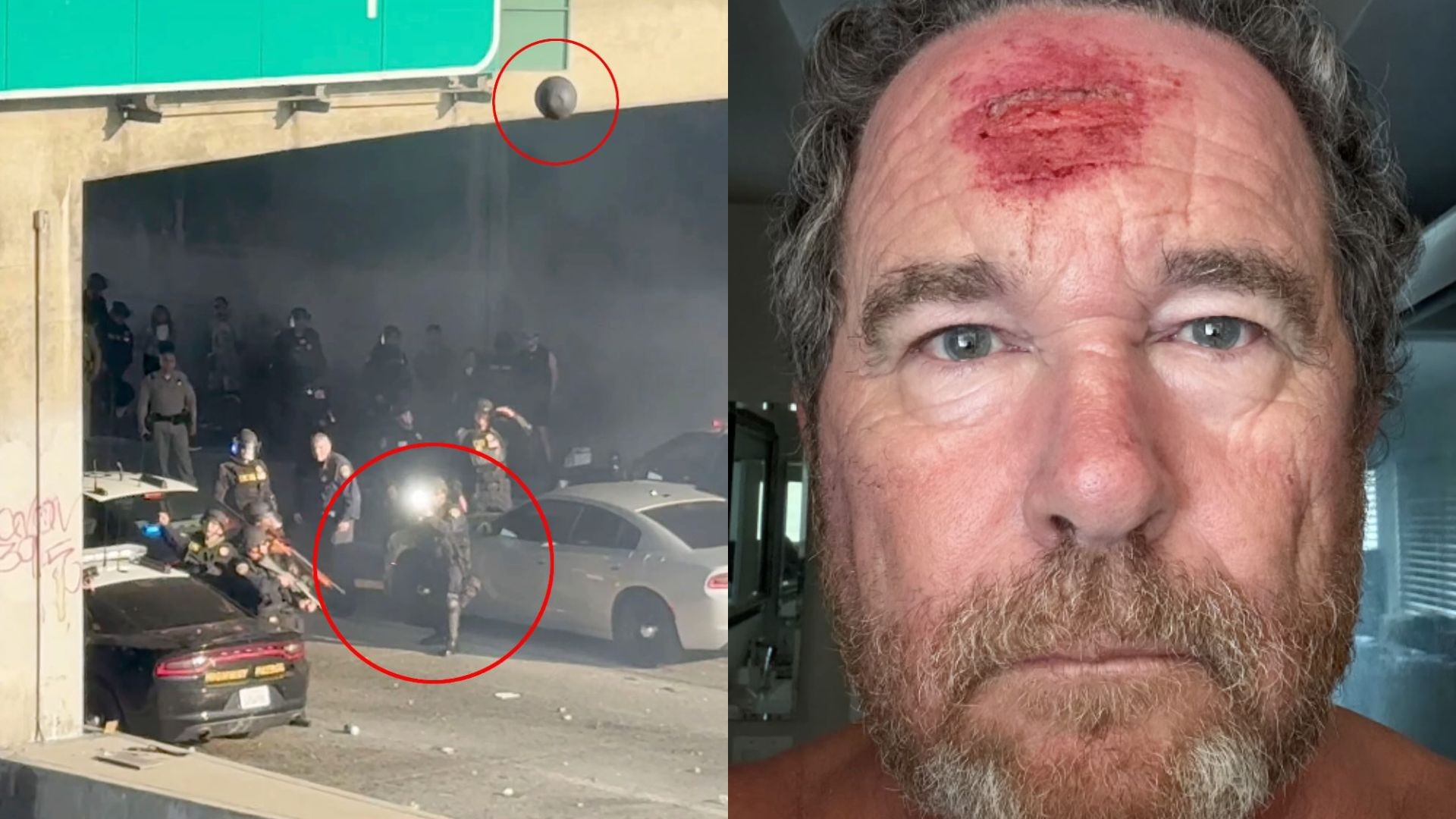 Protestos em Los Angeles: fotógrafo de tabloide conservador é atingido na cabeça por bala de borracha; VEJA